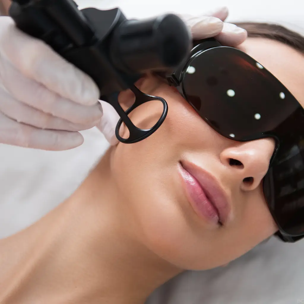 Traitement esthétique laser sur le visage d'une femme