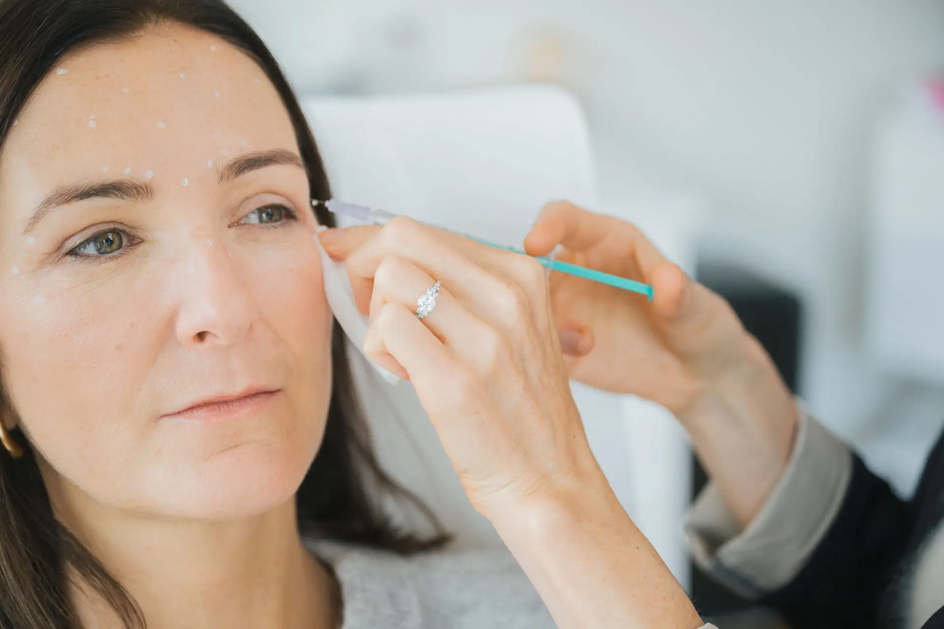 Injection esthétique sur le visage d'une femme