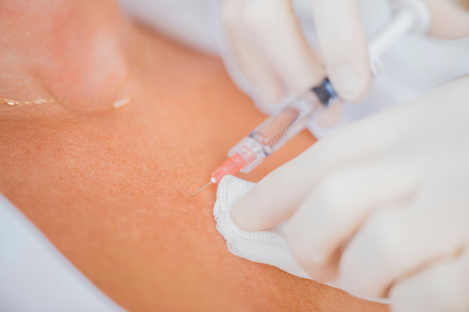 injections de Profhilo dasn un décolleté